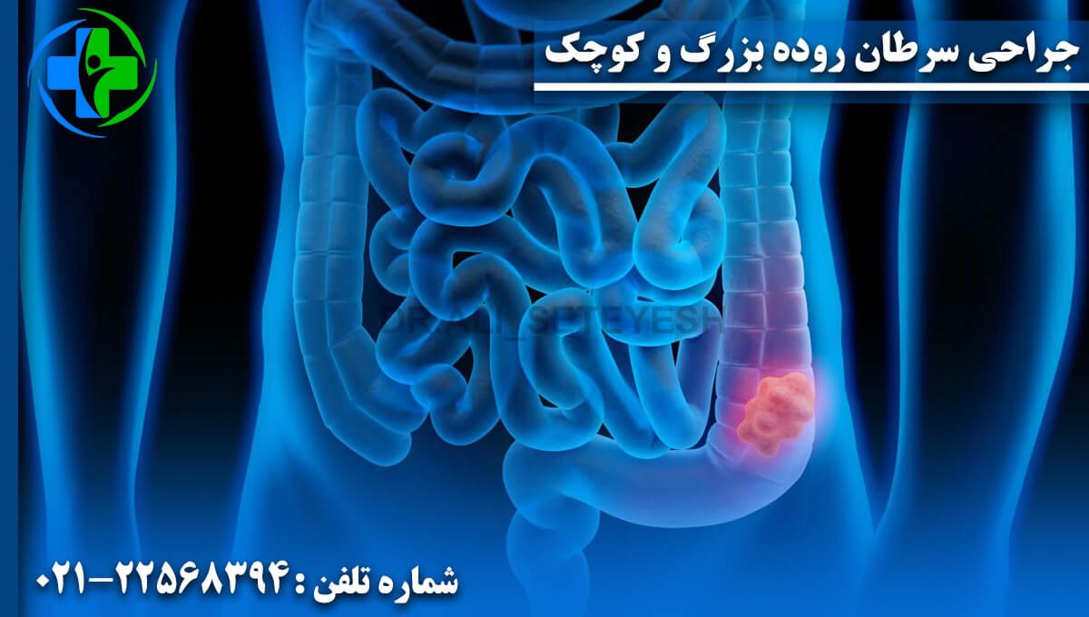 جراحی سرطان روده بزرگ و کوچک