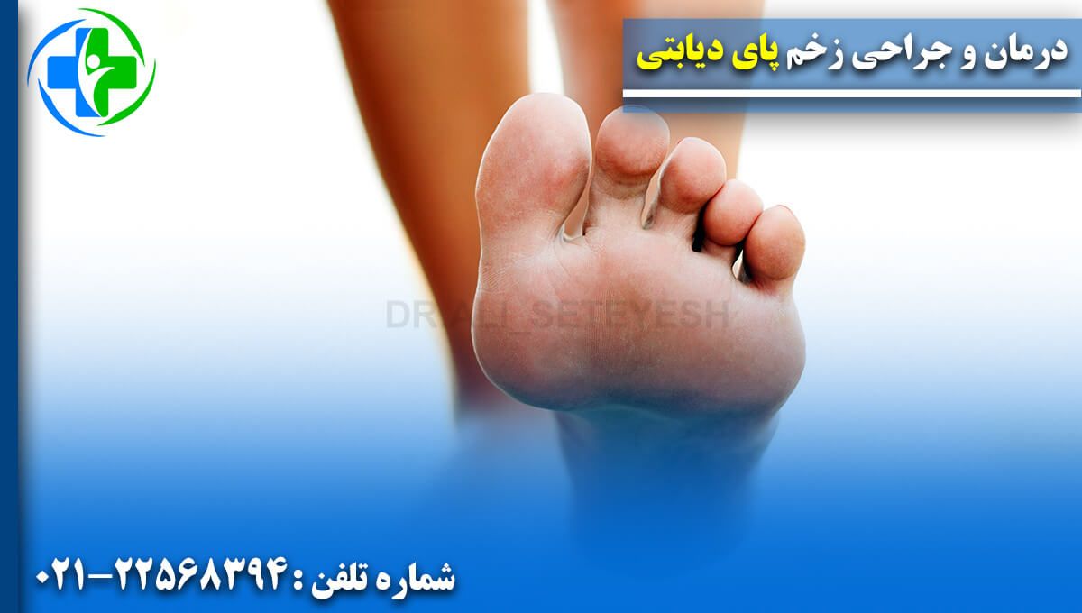 درمان و جراحی زخم پای دیابتی